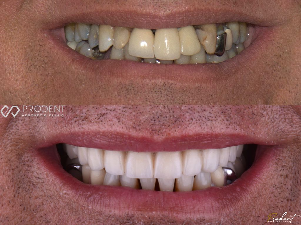 Ulises Pérez Murillo-41