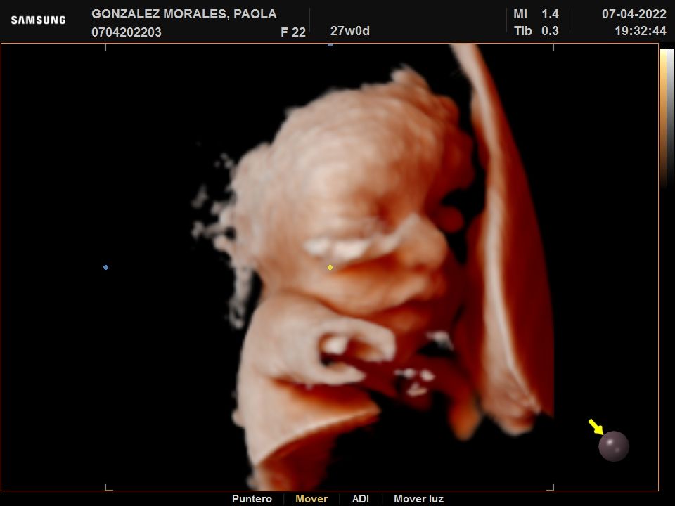 Alejandro Morales Delgado-5