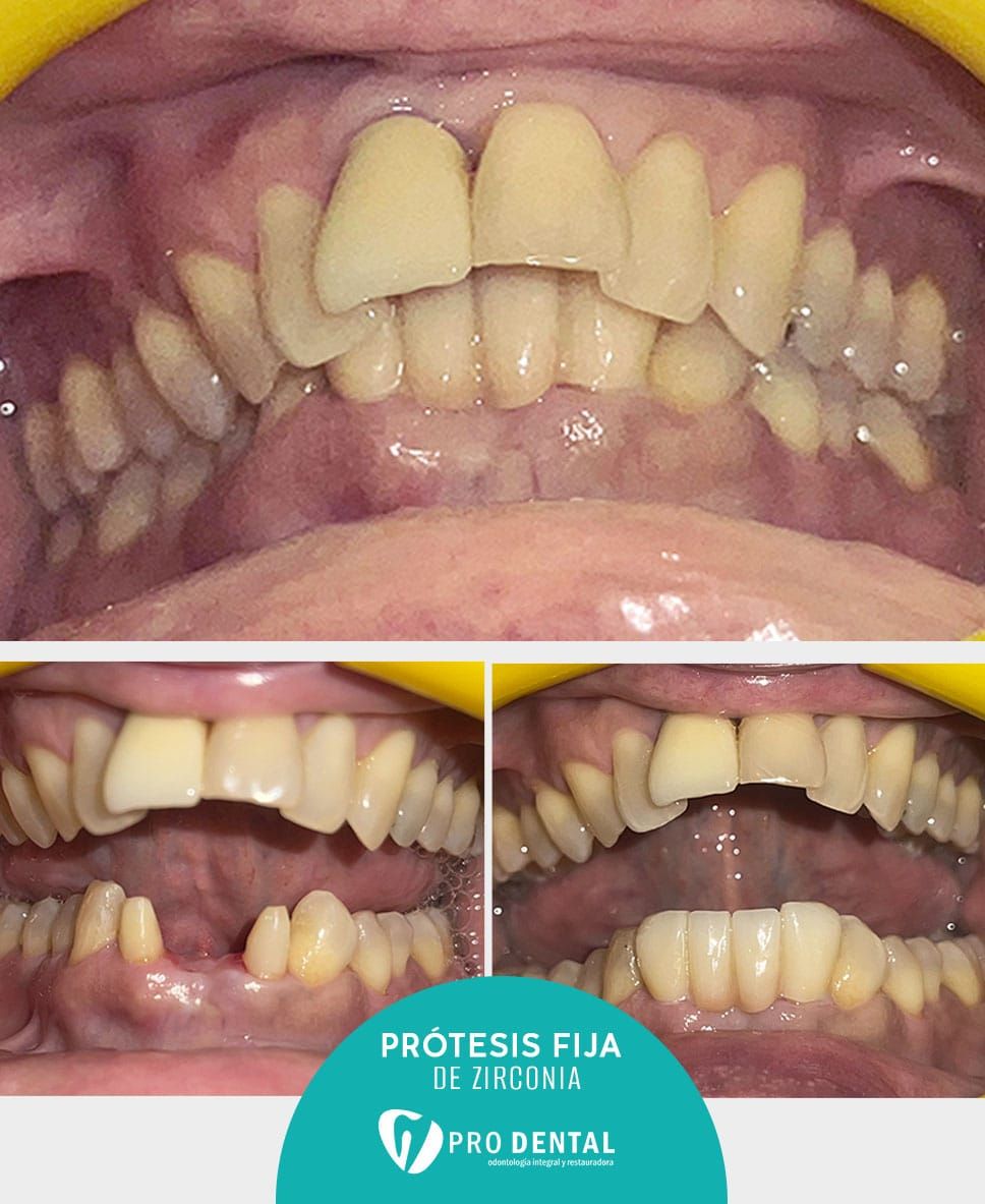 Maria Del Carmen Canul Guzman-6