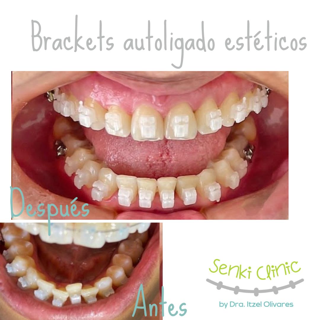 Itzel Olivares Lara-12