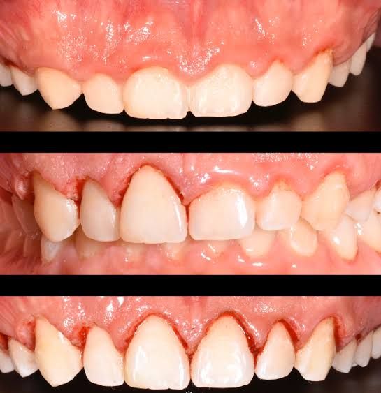 María De Jesús Albuerne Núñez-3