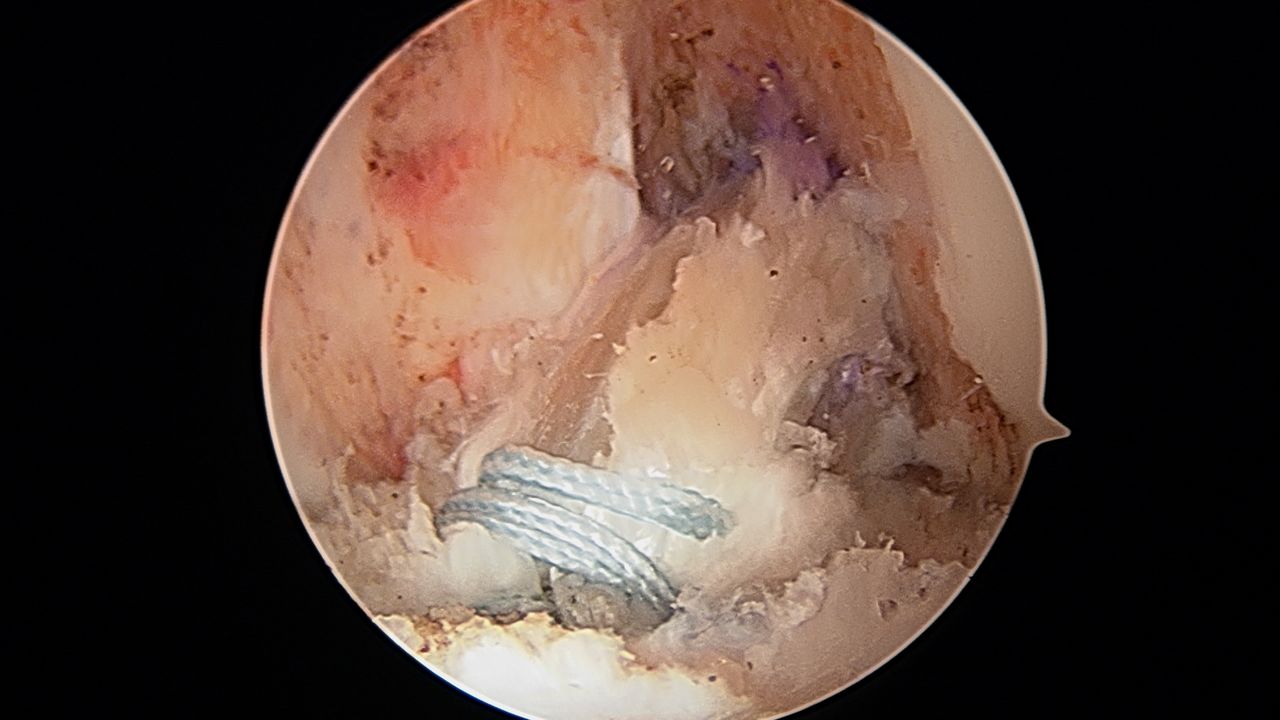 José Antonio Algarín Reyes-28