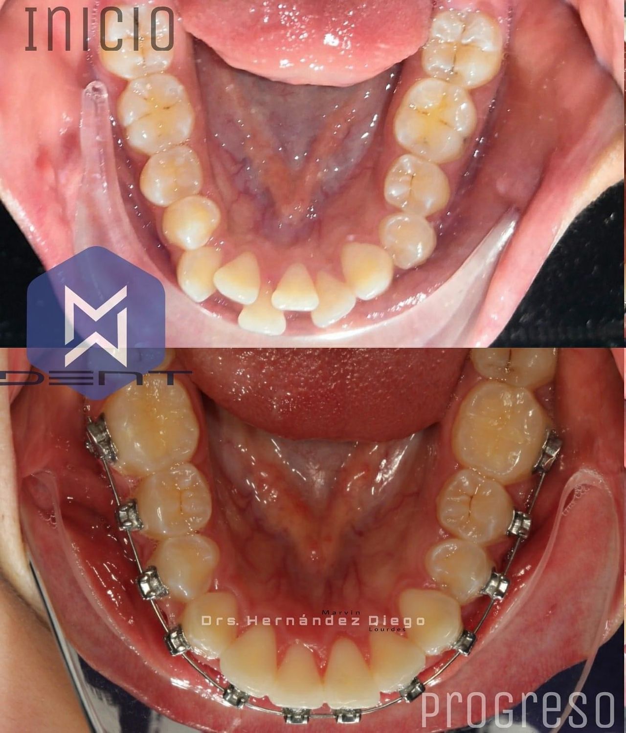 Marvin Adair Hernández Álvarez-30