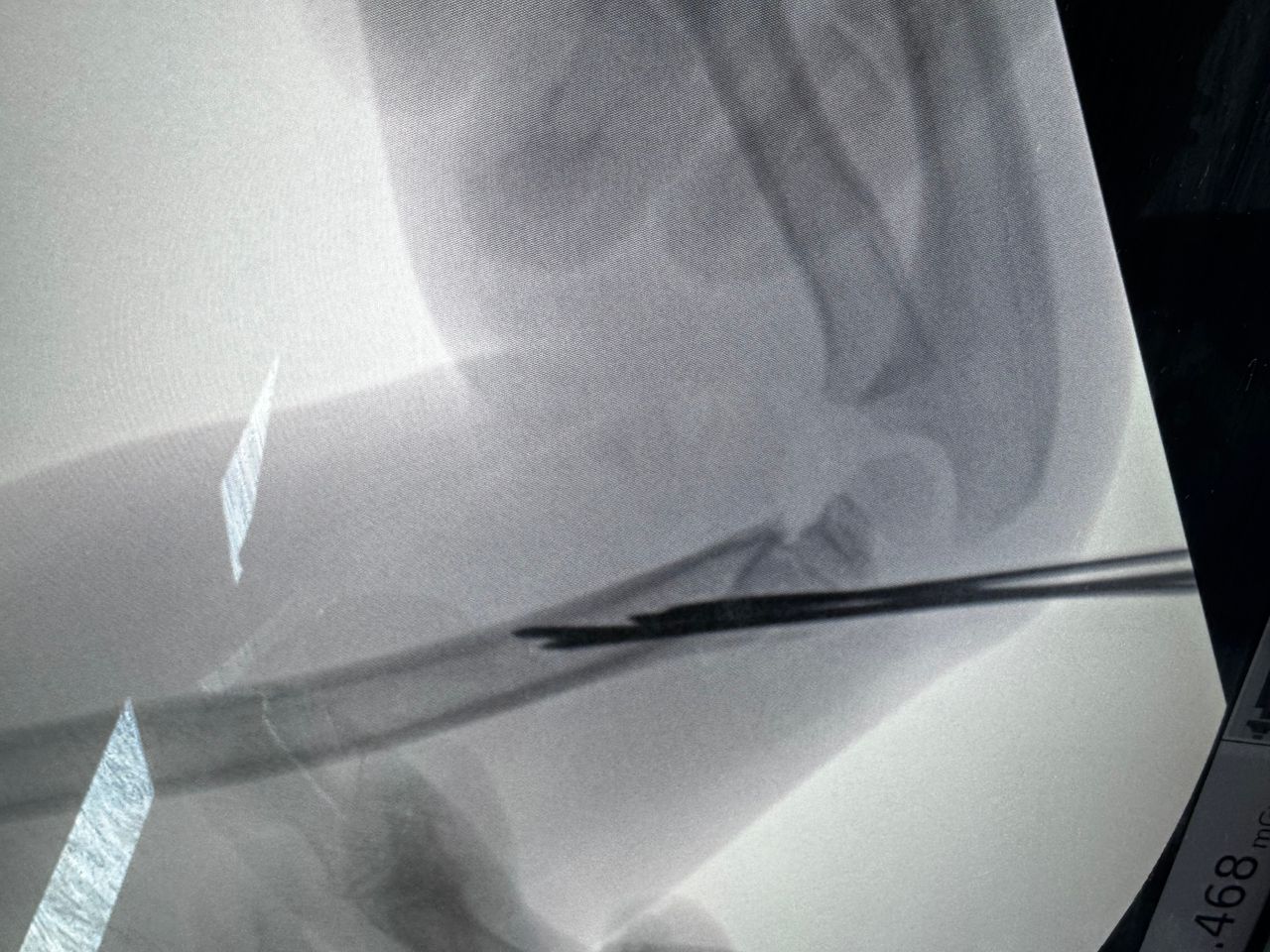 Luis Fernando Cortés Torres-5