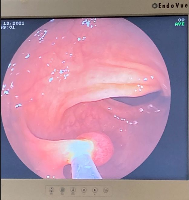 J. César Reyes Vásquez-29