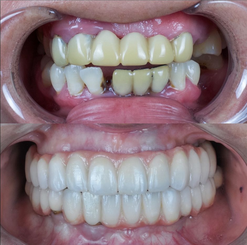 Mario Alejandro Cuellar Caraza-9