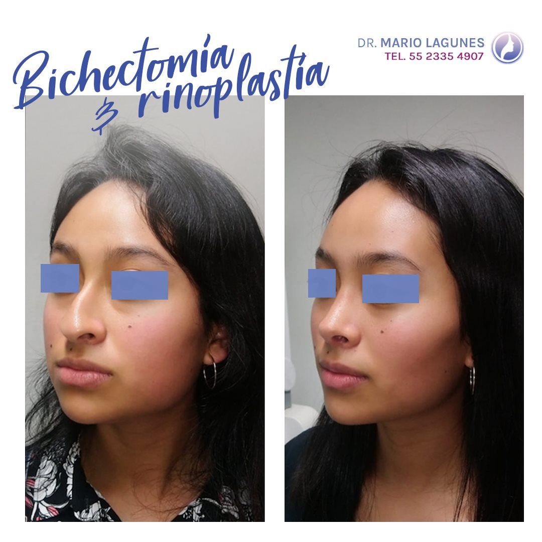 Mario Alberto Lagunes López-3