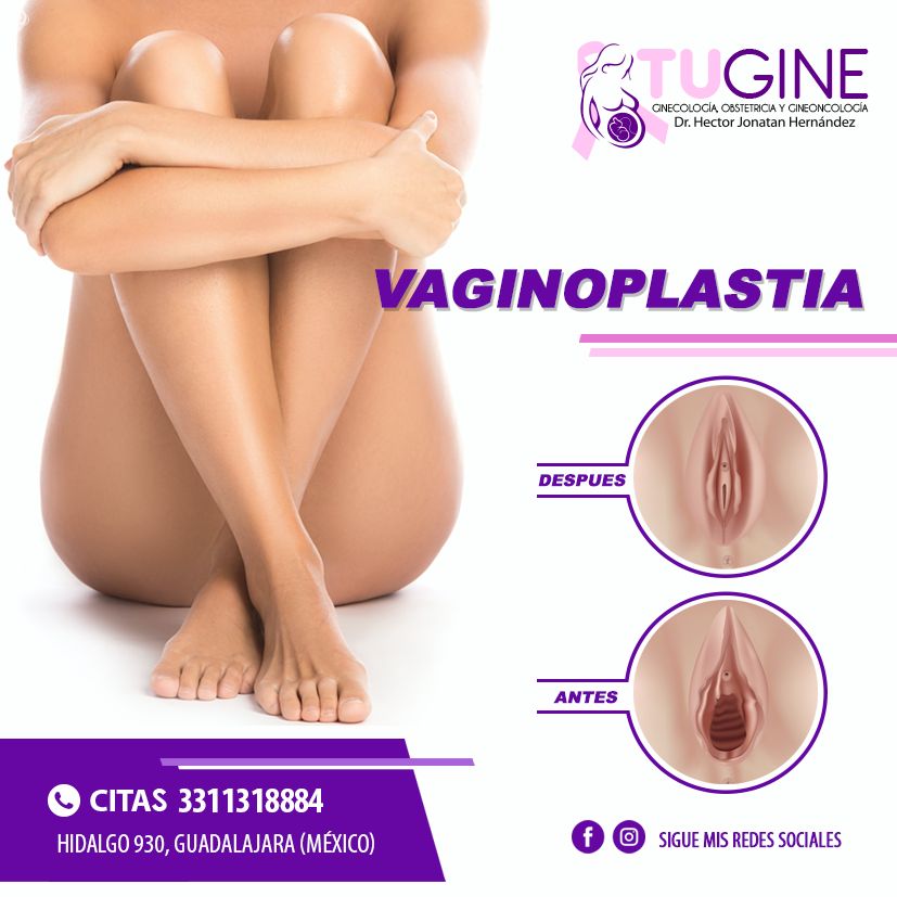 Héctor Jonatan Hernández-3