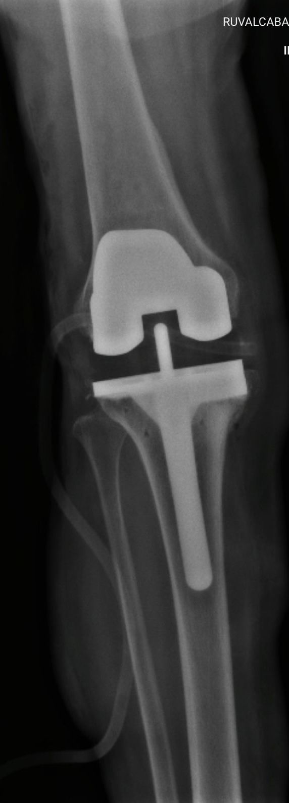 Cristian Ernesto Murillo Medina-7