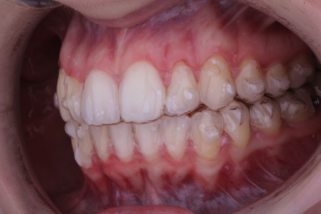 Josué Márquez Gómez-31