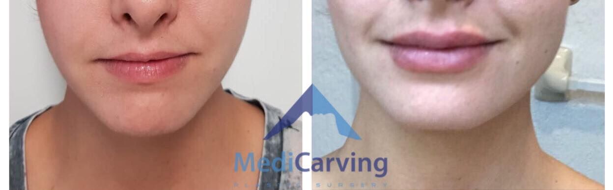 Rafael Velázquez Razo-6