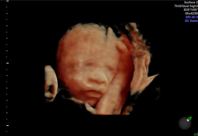 Graciela Elizabeth De La Torre Alvarez-15