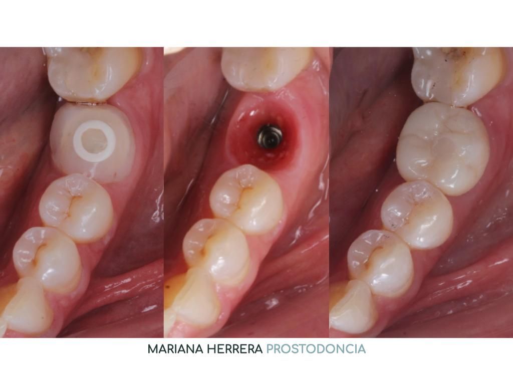 Mariana Herrera Martín Del Campo-18