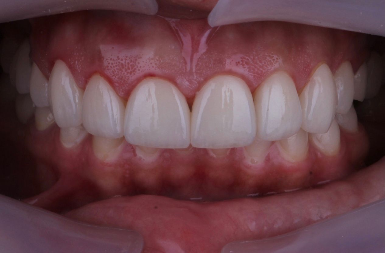 Josué Márquez Gómez-53