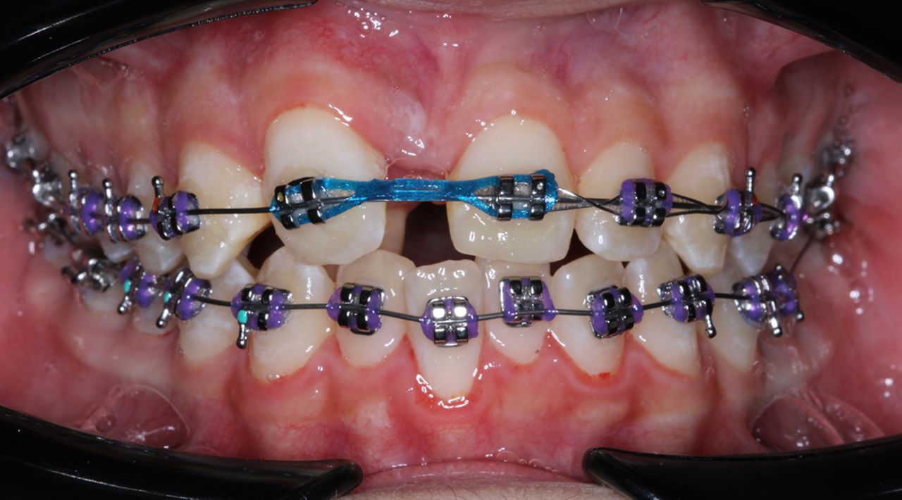 Erika Monserrat Quiroz Martínez-11