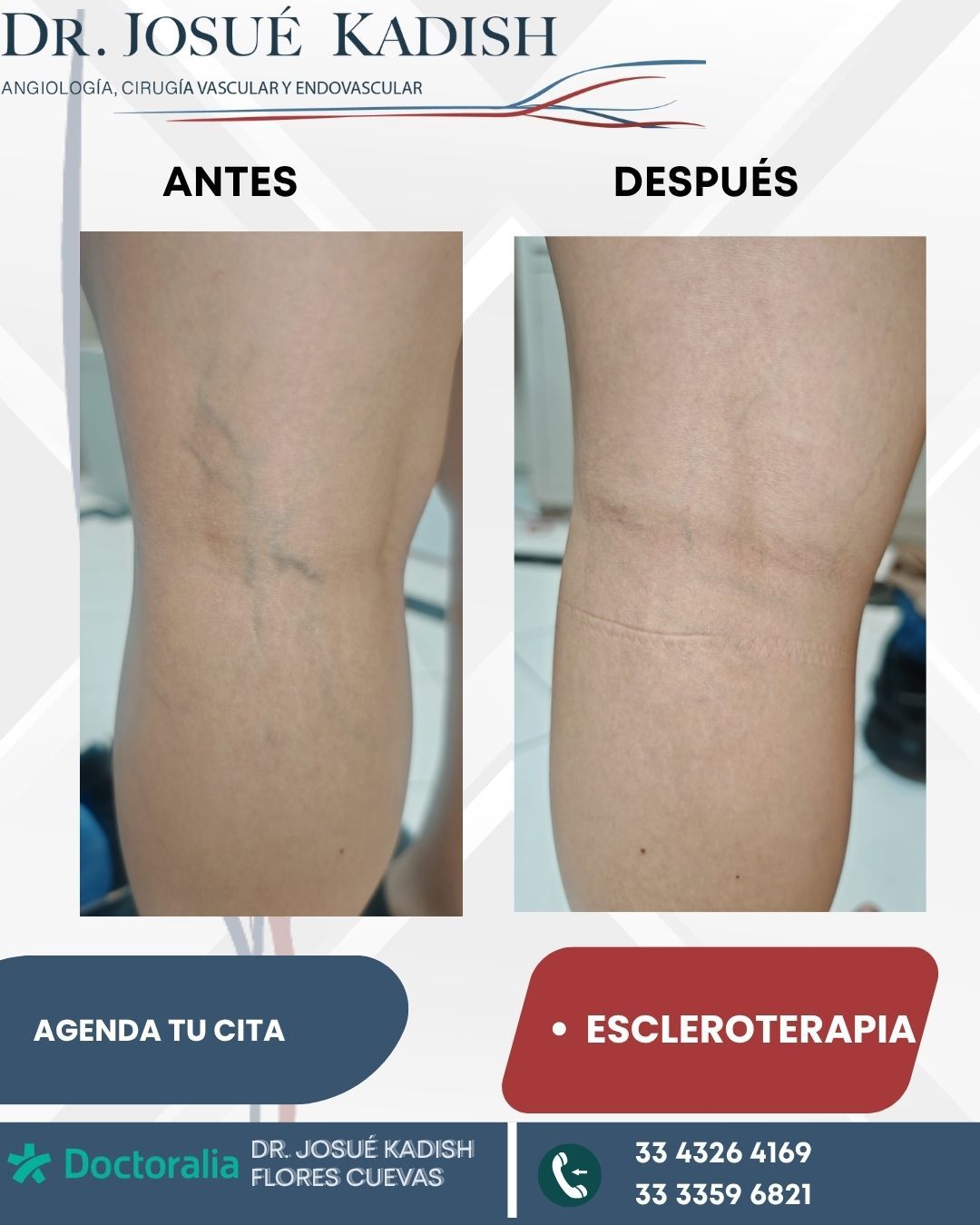 Josue Kadish Flores Cuevas-3