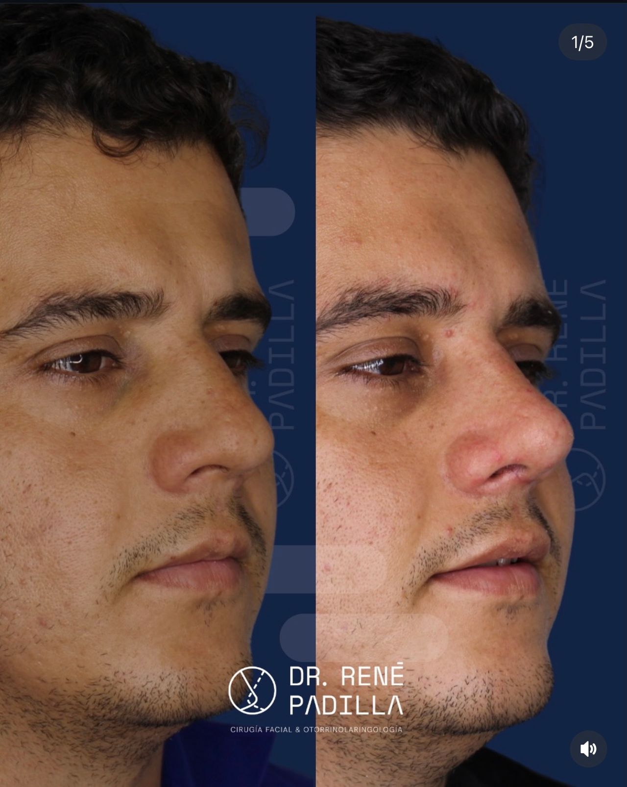 René Emmanuel Padilla López-7