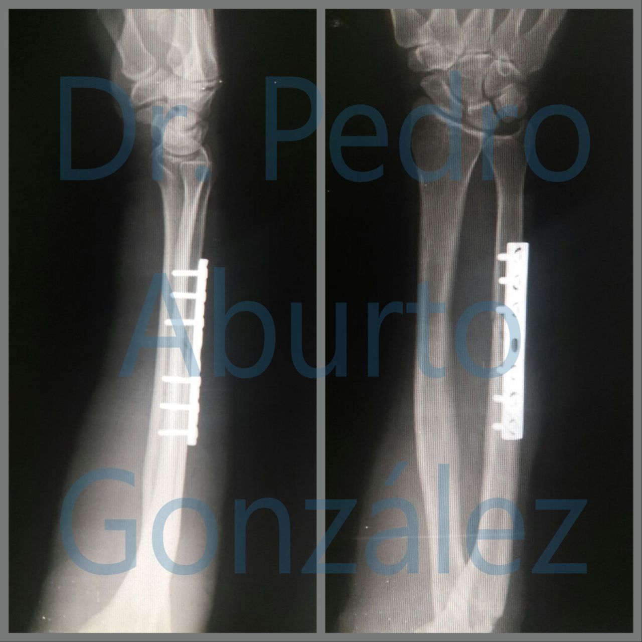 Pedro Aburto González-10