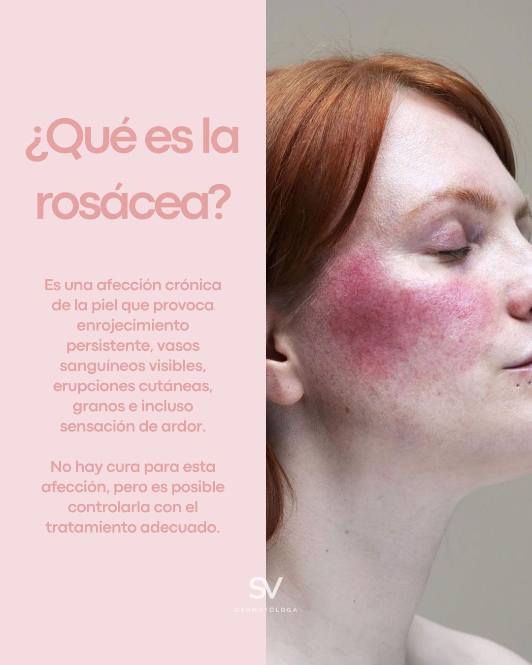 Sandra E. Vázquez Lares-11