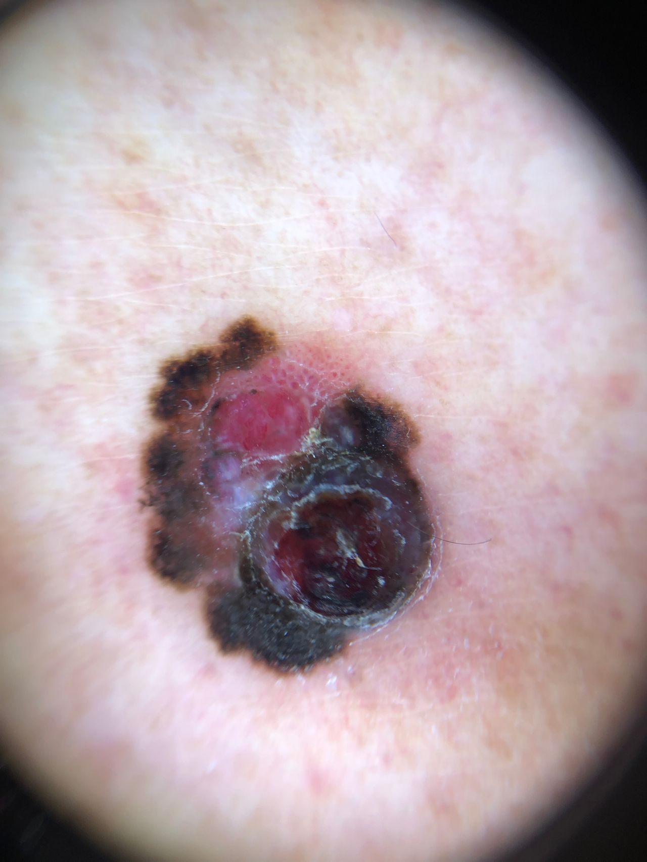 Hazel Rachelle Bracho Olvera-0