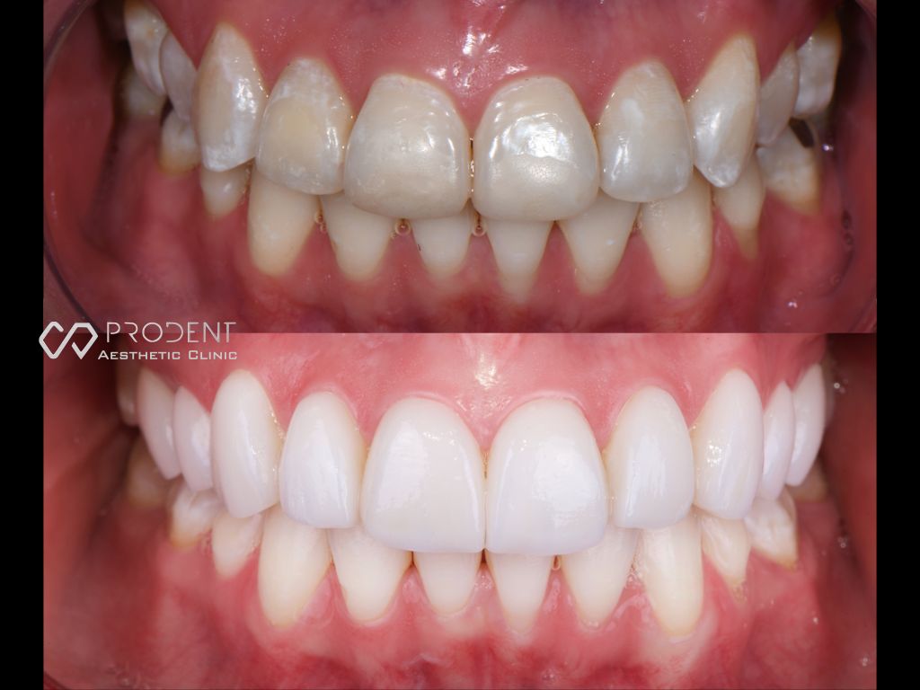 Ramiro Ivan Pérez Murillo-58