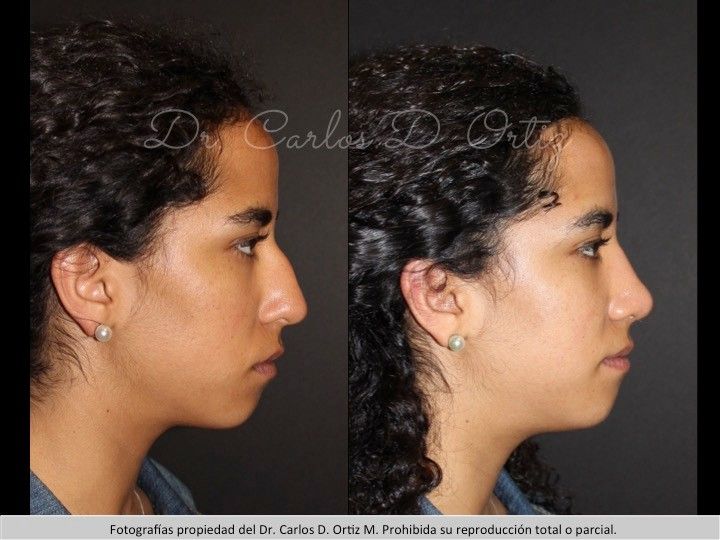 Carlos David Ortiz Moreno-66