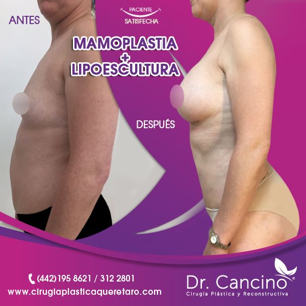 Luis M. R. Cancino-50