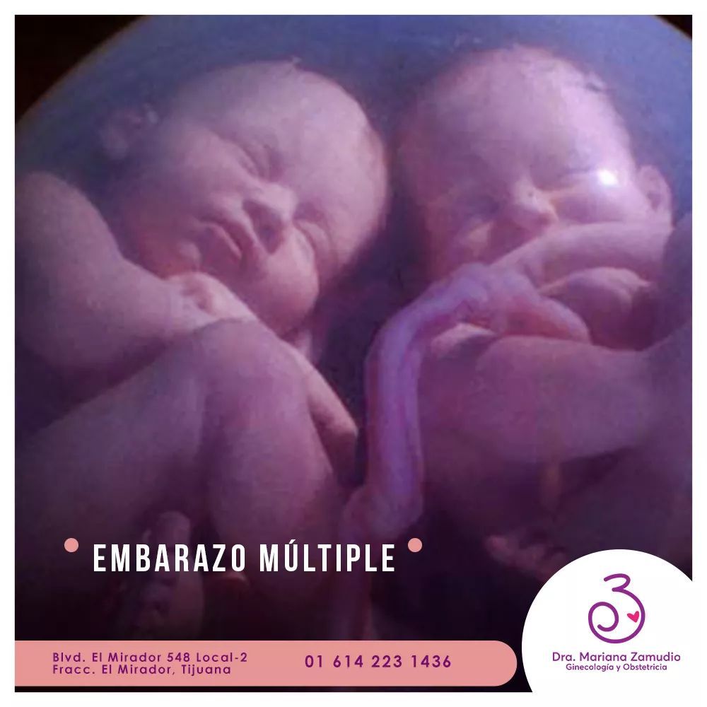 Carla Mariana Zamudio Valdez-2