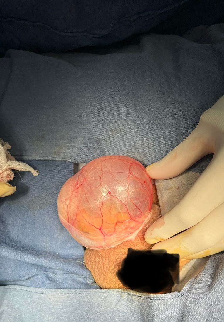 Marco Antonio Sillas Martínez-25