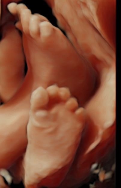 Nallely Moreno  Uribe-5