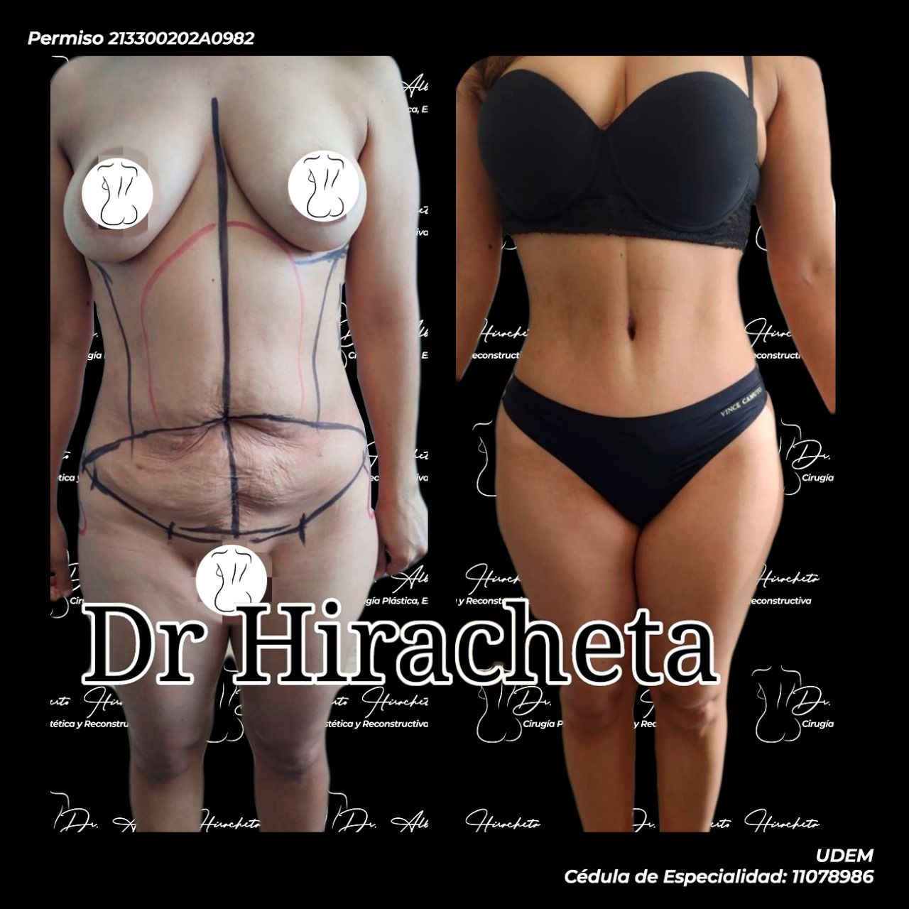 Alberto Hiracheta Torres-11