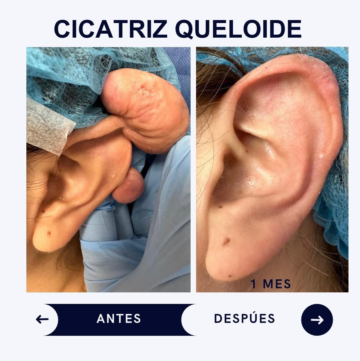 Itzel Anayn Flores Reyes-17