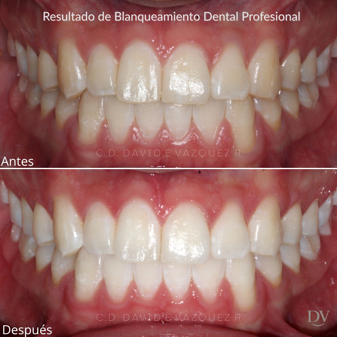 David Emmanuel Vázquez Rosas-1