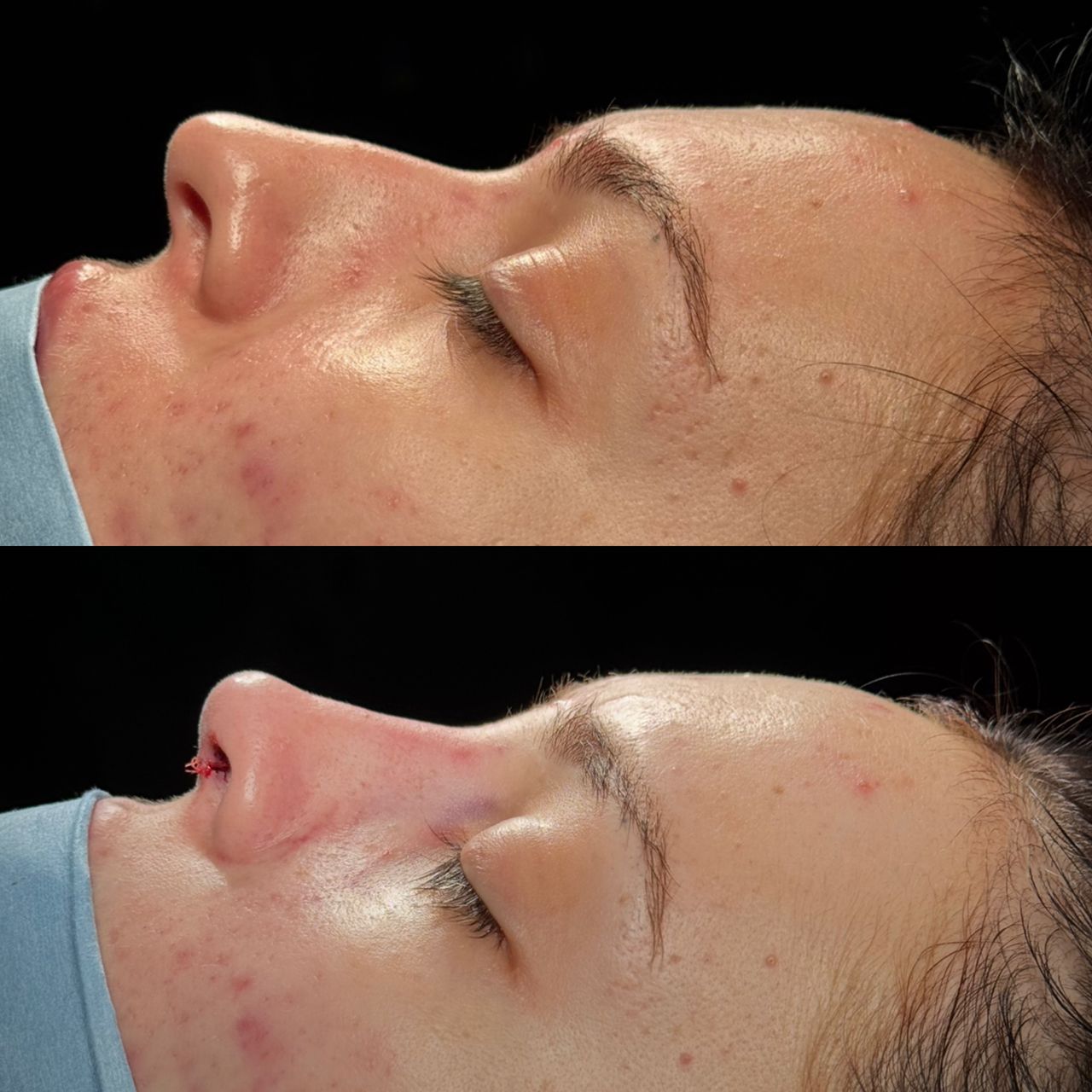 Angel Castro Urquizo-209