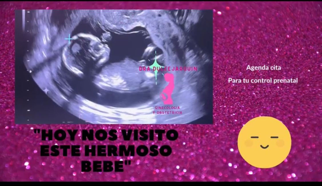 Dulce Anabel Jarquin Arango-24