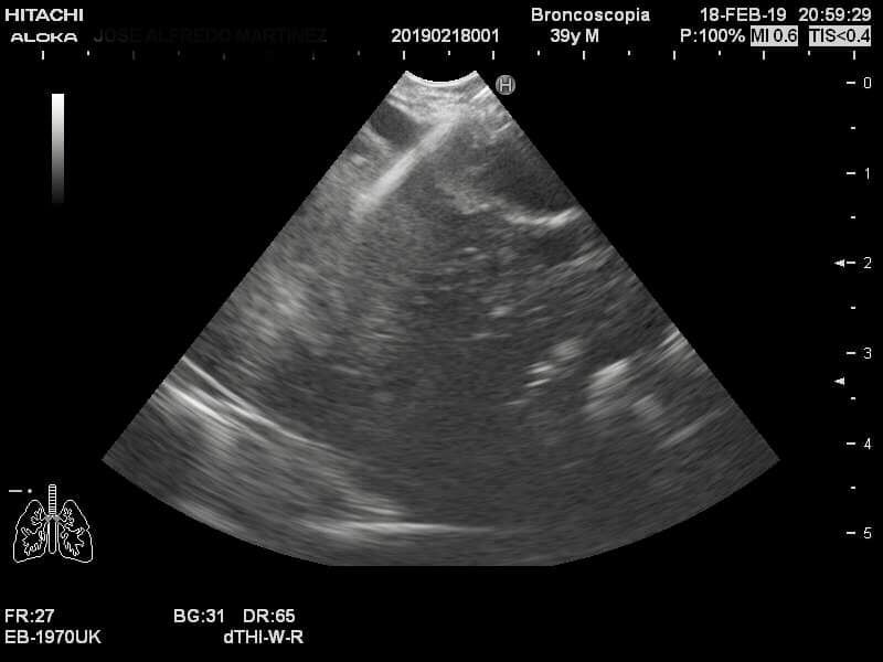 Alejandro Marin Castañeda Baron-10