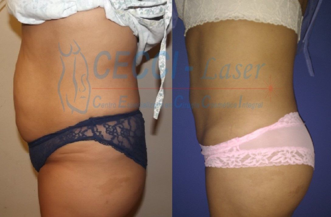 José Leopoldo Rojas Garza-3