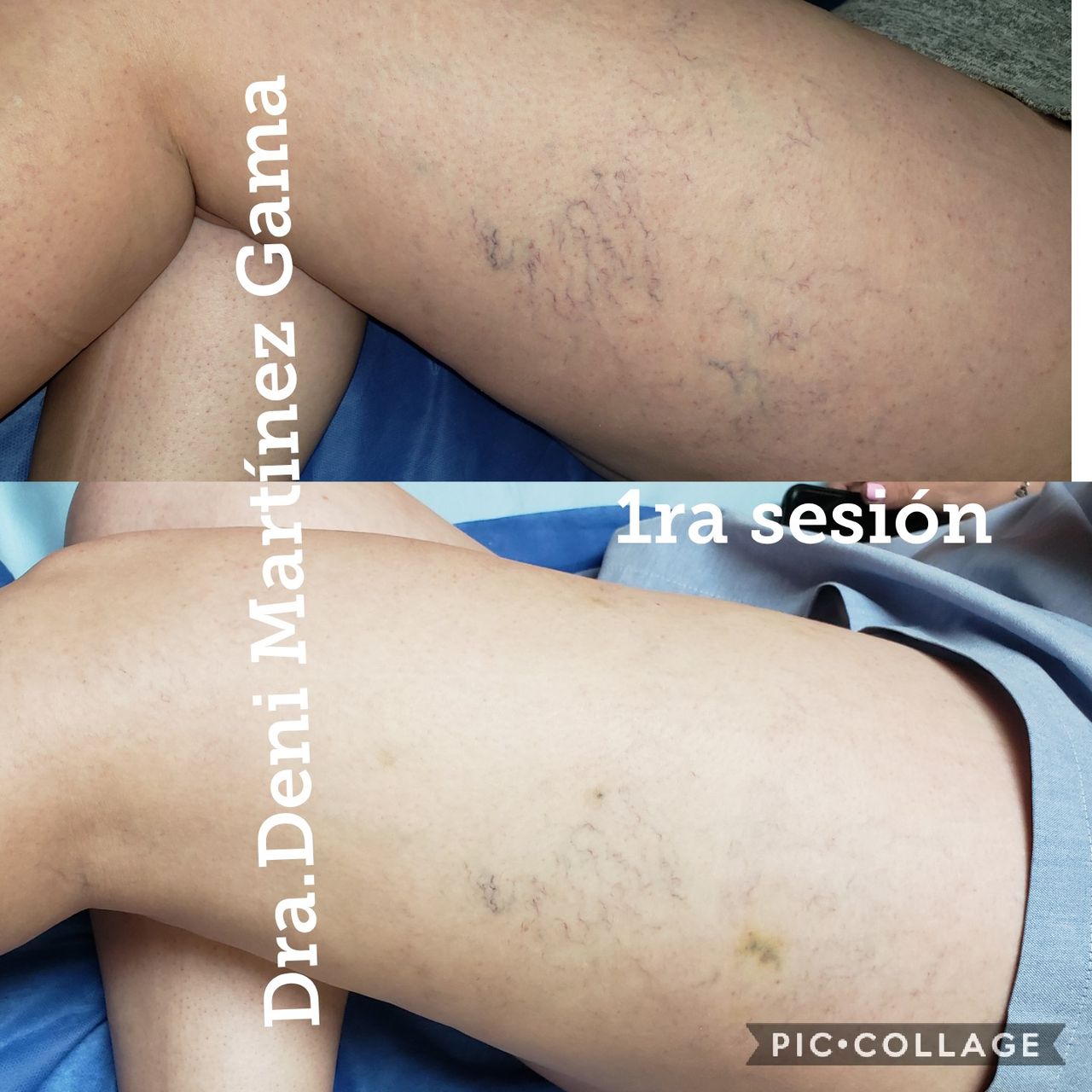 Deni Martínez Gama-16