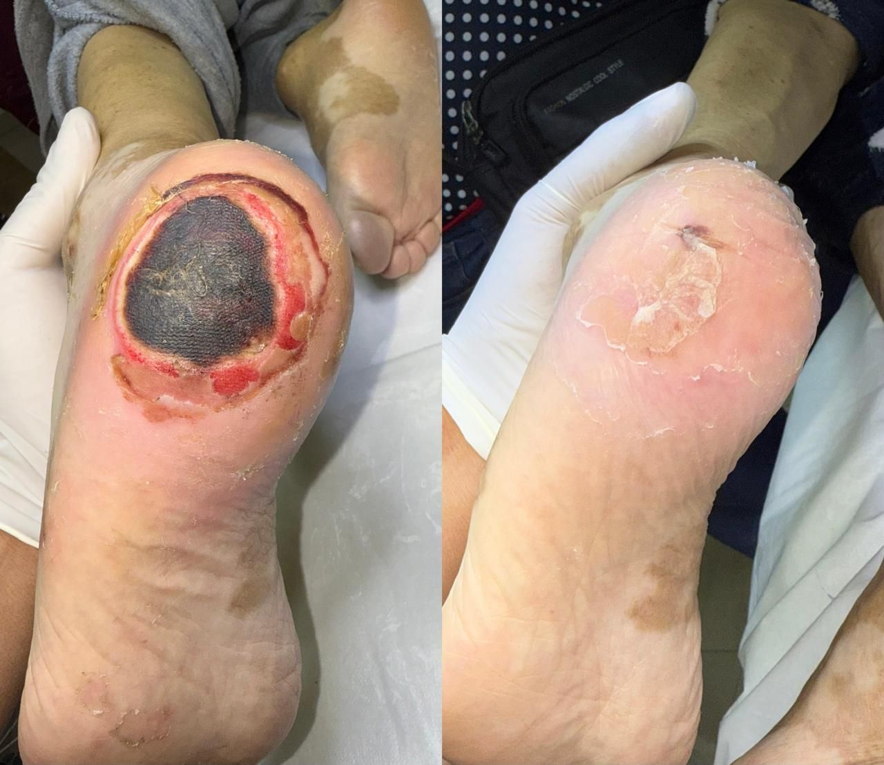 Jhonatan López González-6