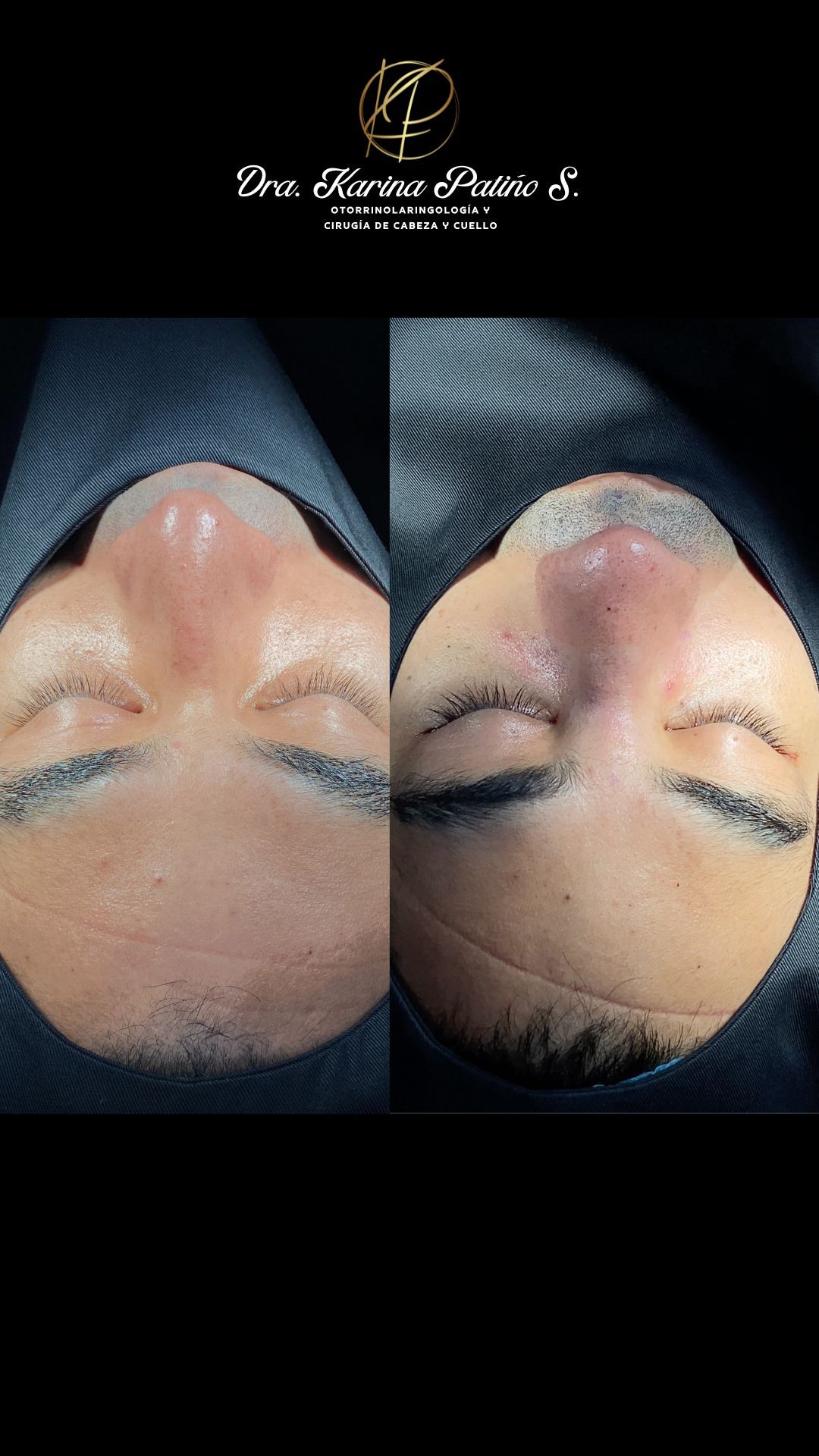 Karina Patiño S.-14