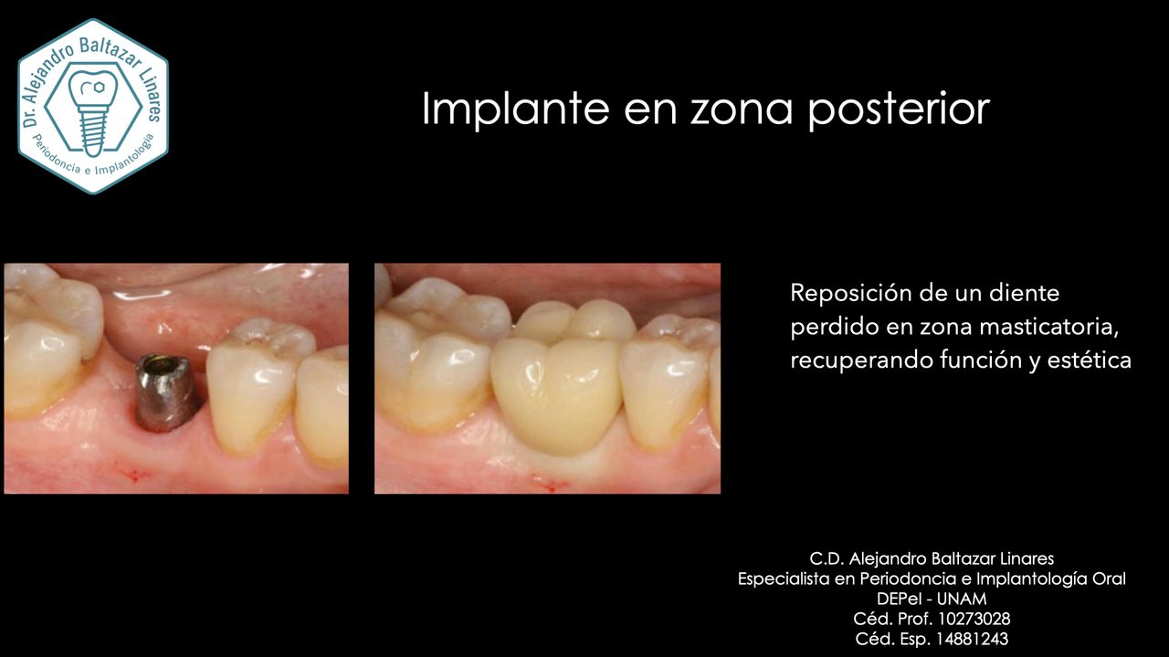 Alejandro Baltazar Linares-4