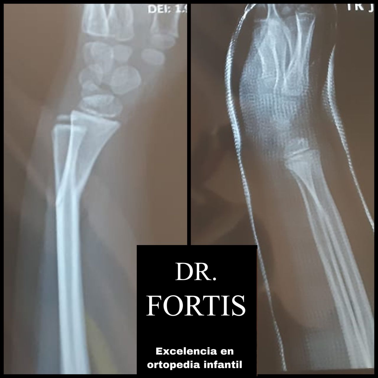 Ignacio Osvaldo Fortis Olmedo-9
