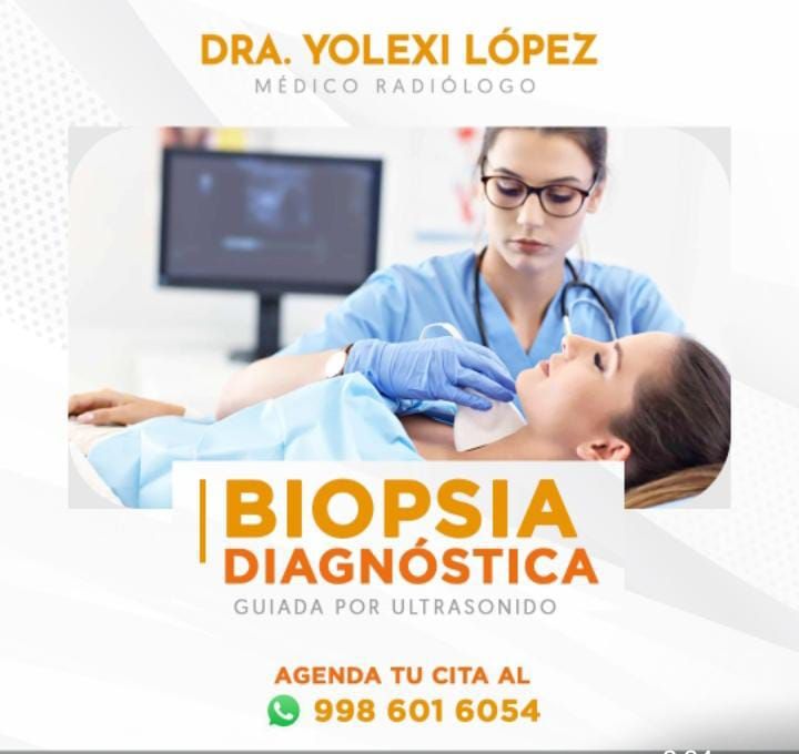 Yolexi López Neyra-0