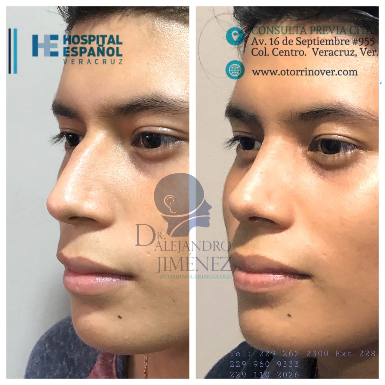 Alejandro Jimenez Garcia-26