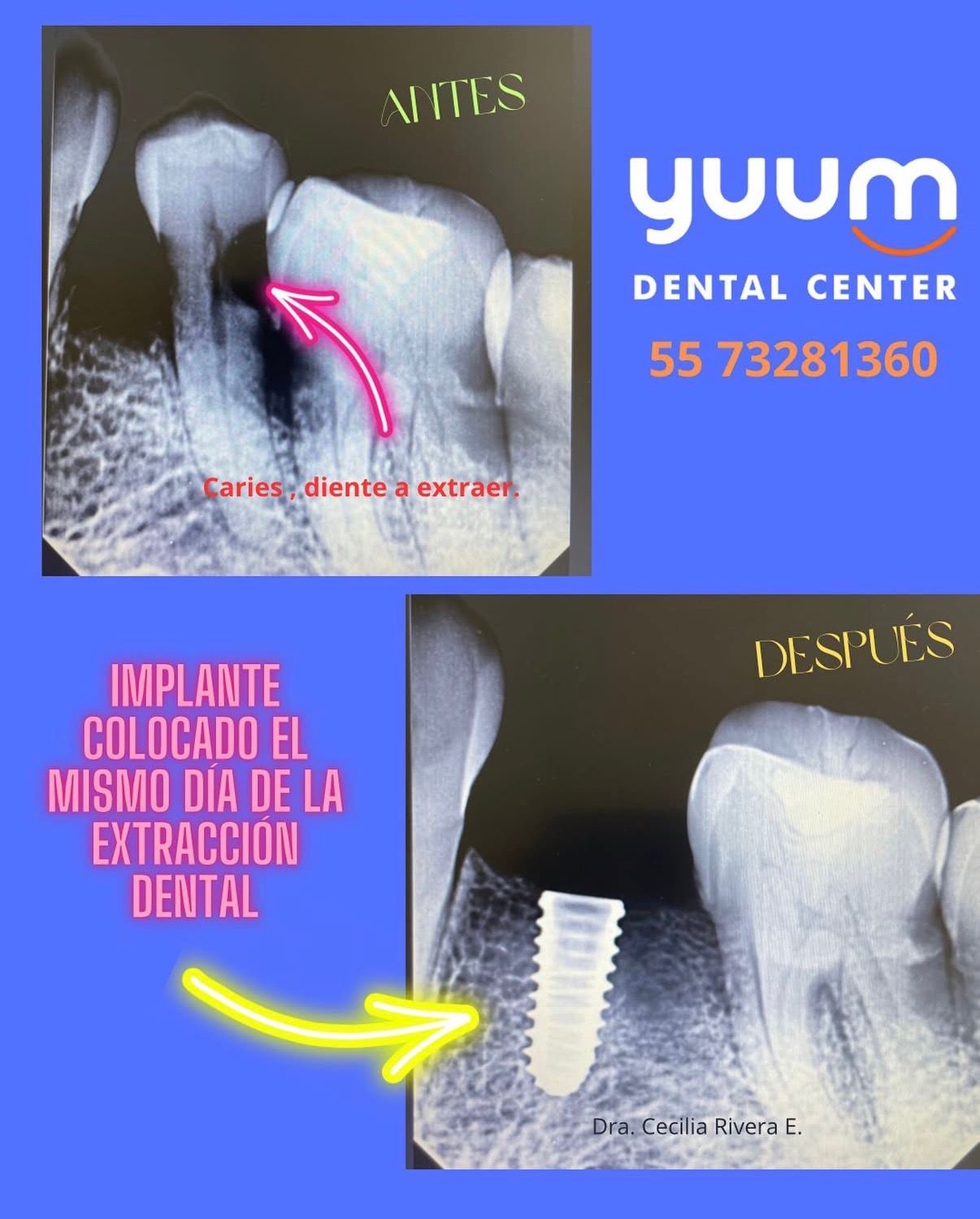 Cecilia Rivera Elizalde-12