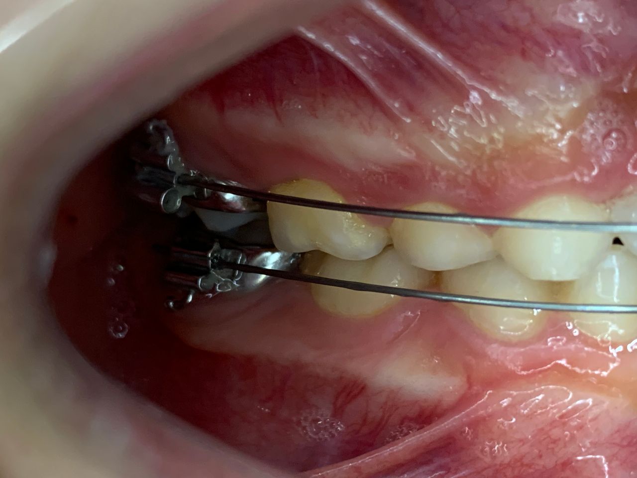 Patricia Rizo Palos-5