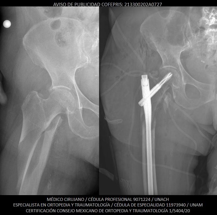 Luis Castañón Robles-9
