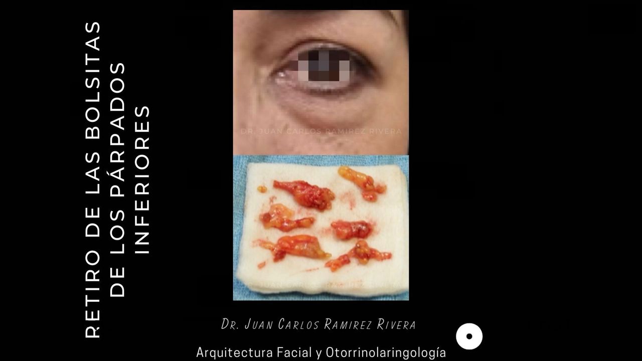 Juan Carlos Ramirez Rivera-10