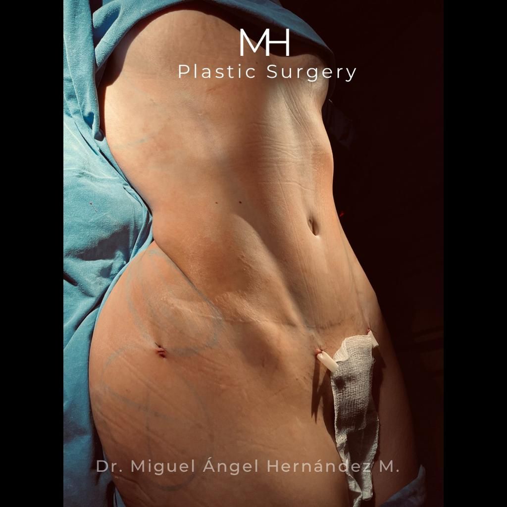 Miguel Angel Hernández Muñoz-0