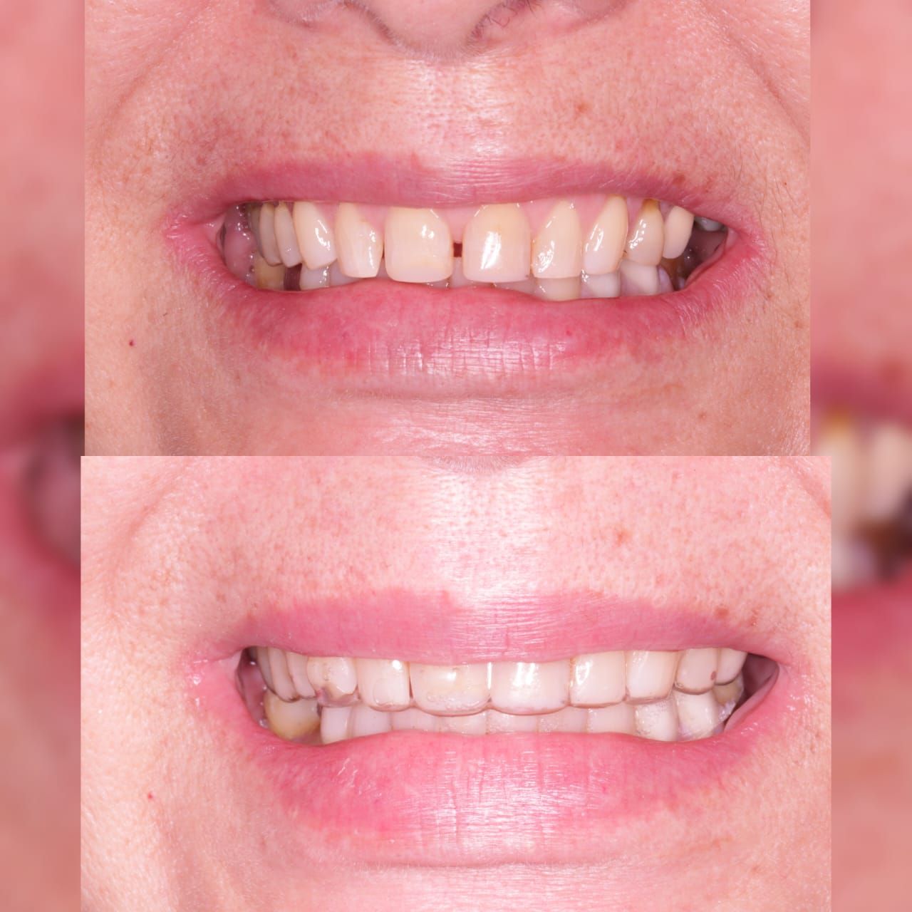 Zurisadai Salinas Chávez-13